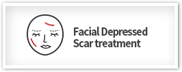 Facial Depressed Scar treatment