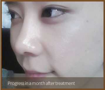 Progress in a month after treatment